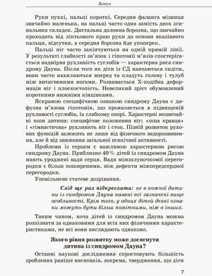 Инклюзивное обучение. Ребенок с синдромом Дауна