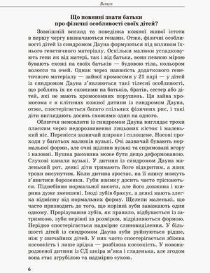 Инклюзивное обучение. Ребенок с синдромом Дауна